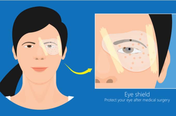 Eye shield used during recovery from detached retina surgery