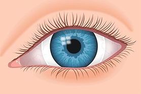 scleral lens in eye