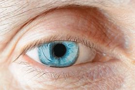 man wearing a PMMA contact lens