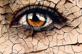 closeup of a dry eye with dry cracked skin and eye overlay