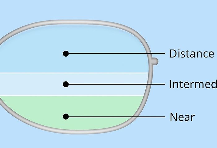 Bifocals and trifocals: Still good options in some cases