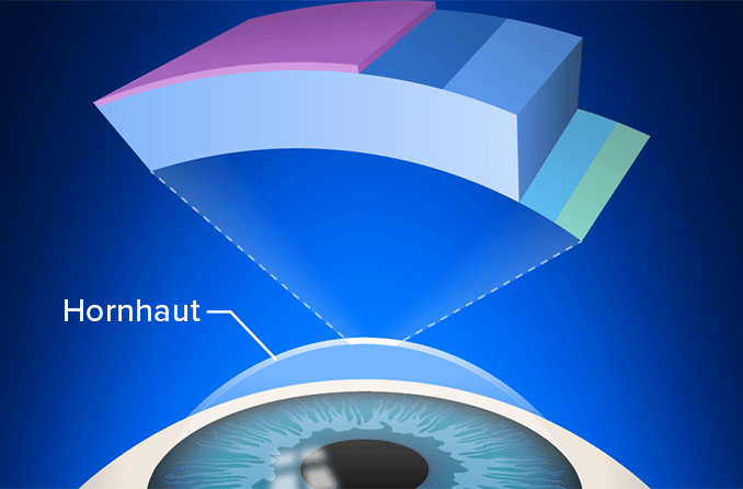 Fuchs-Endotheldystrophie: Ursachen, Symptome, Risiko und Behandlung