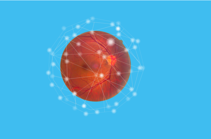 Derrames oculares: oclusiones de las arterias y venas retinianas