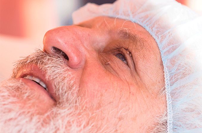 Tumor en el ojo o papiloma de párpado: tipos, síntomas y tratamientos