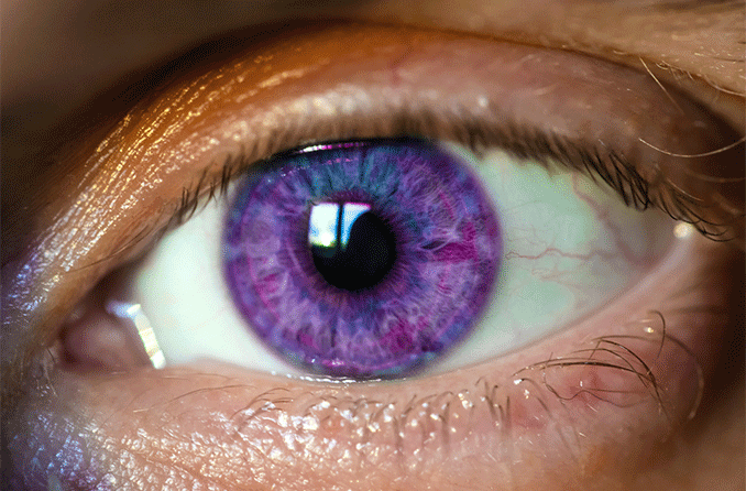 Síndrome de Alejandría: Ojos Violetas y Visión Perfecta