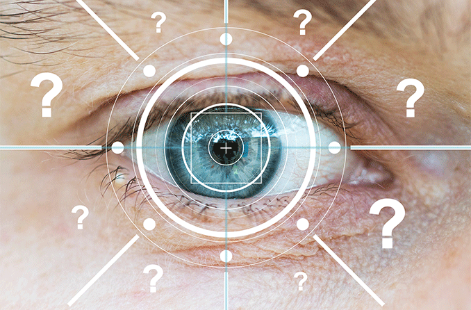¿Cuánto dura la queratomileusis in situ asistida con láser (LASIK)? ¿Es permanente?