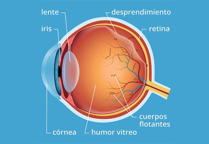 Moscas volantes: Tratamento a laser, sintomas, causas